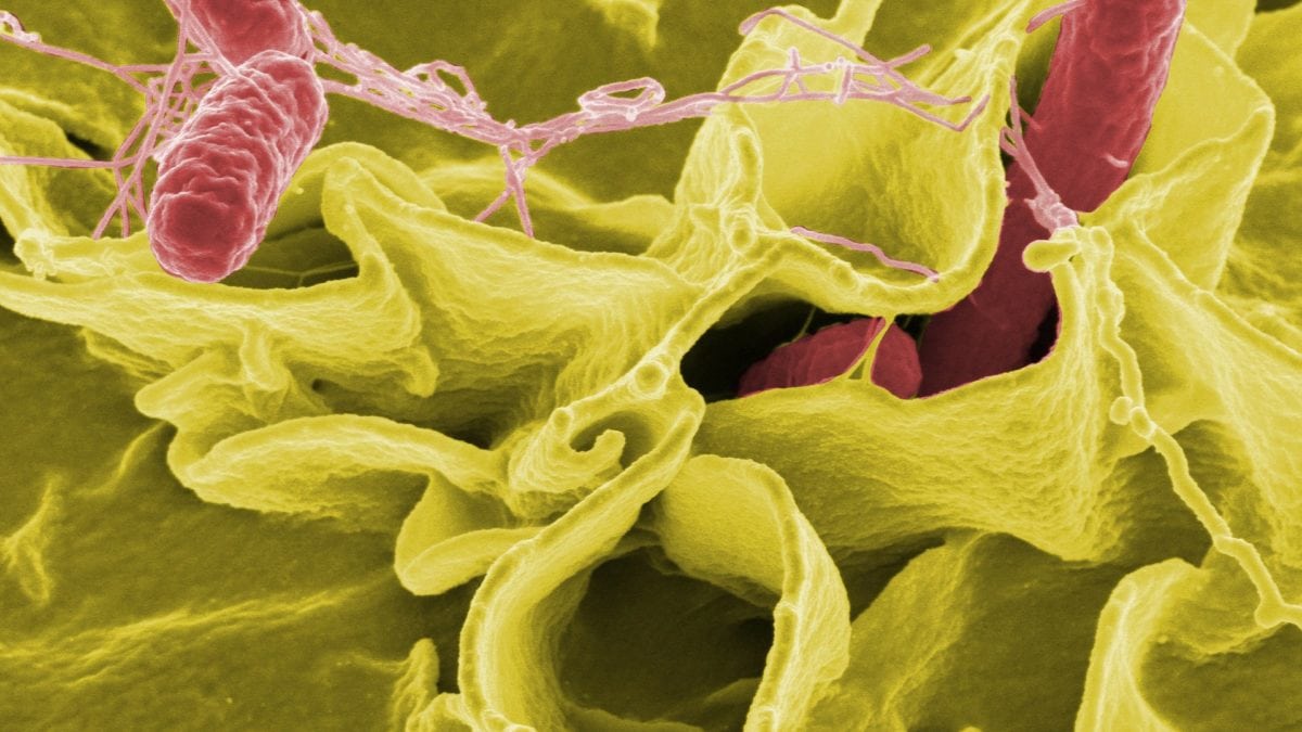 Ein Bakterienstamm gelb und rot eingefärbt, zu sehen unter dem Mikroskop